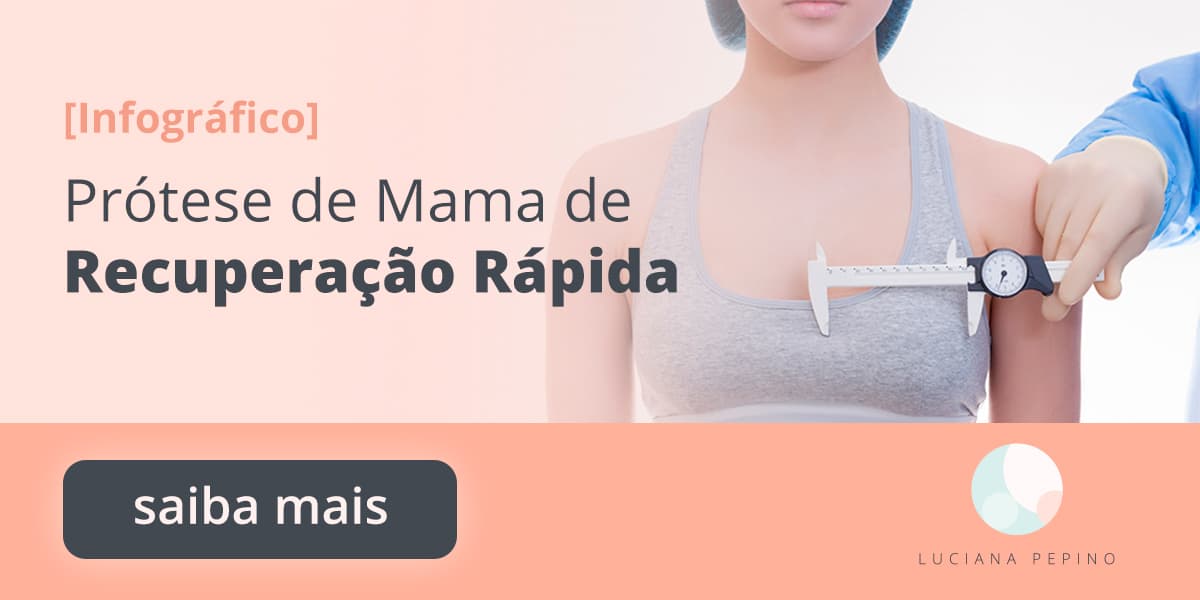 Prótese de mama de recuperação rápida - tudo sobre a técnica R24R