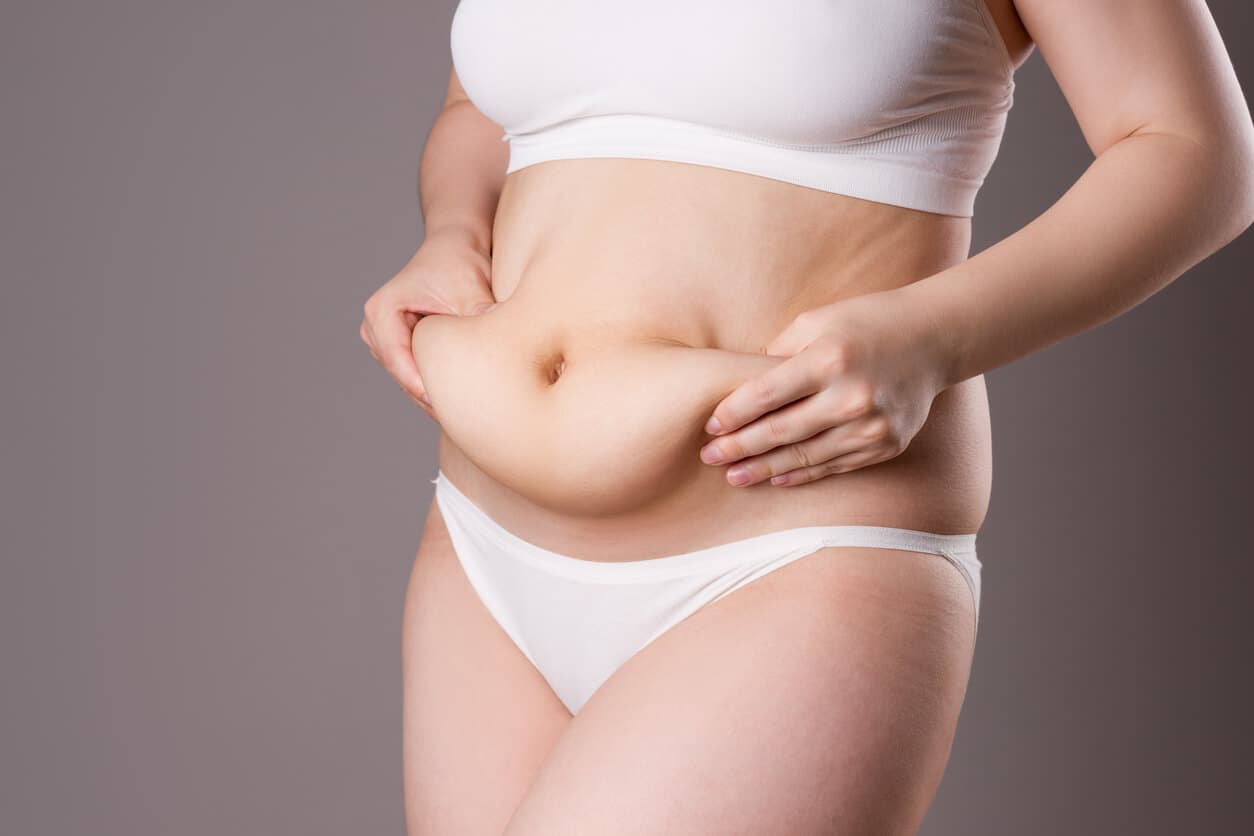 Torso de uma mulher vestindo roupas íntimas brancas, com as mãos na barriga, segurando o excesso de pele e evidenciando a flacidez pós emagrecimento
