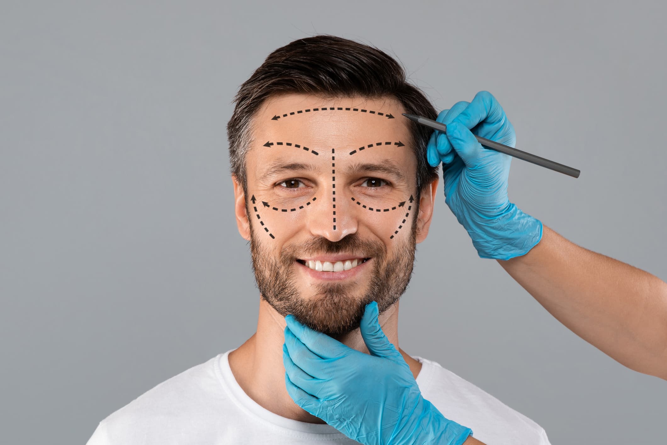 Harmonização facial masculina conheça mais sobre