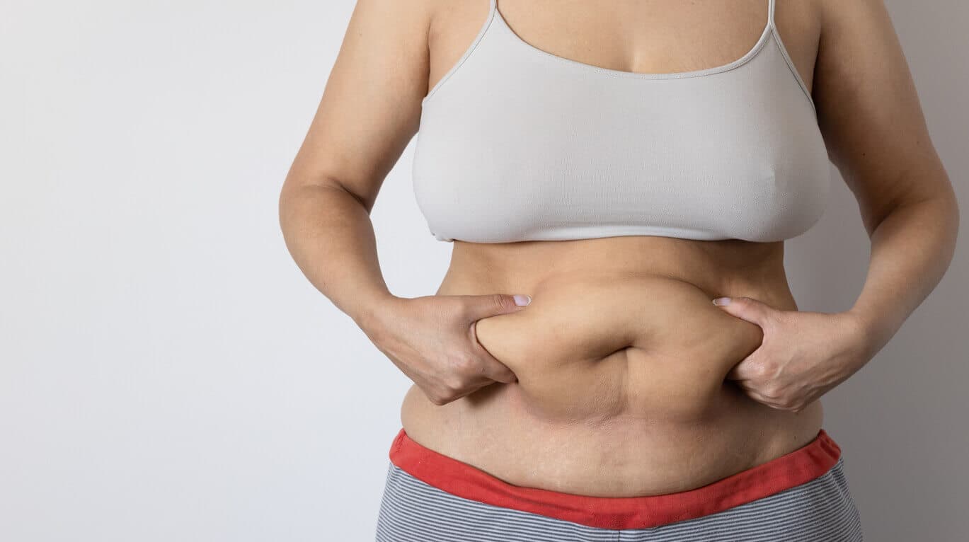 Mulher com barriga flácida segurando o excesso de pele no abdômen
