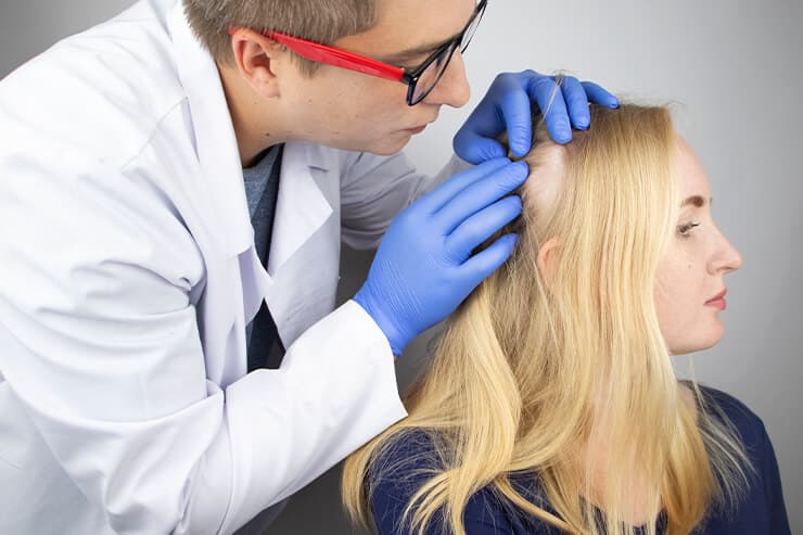 conheça mais sobrea a alopecia cicatricial e como é feito o tratamento