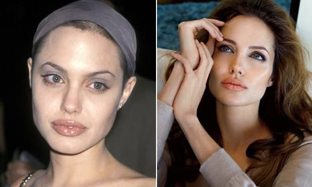 angelina jolie cirurgia plastica