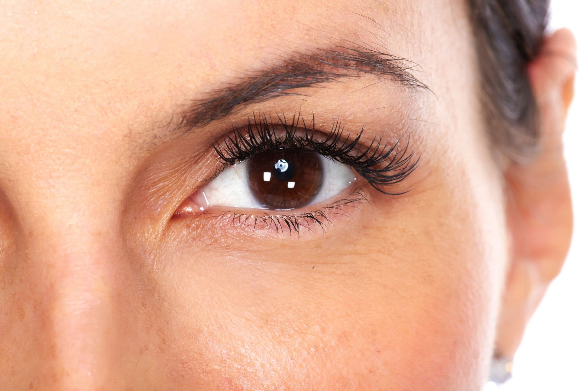 Blefaroplastia - Cirurgia para Pálpebras