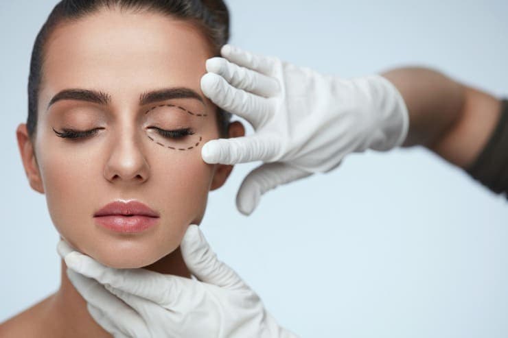 Entenda tudo sobre a blefaroplastia