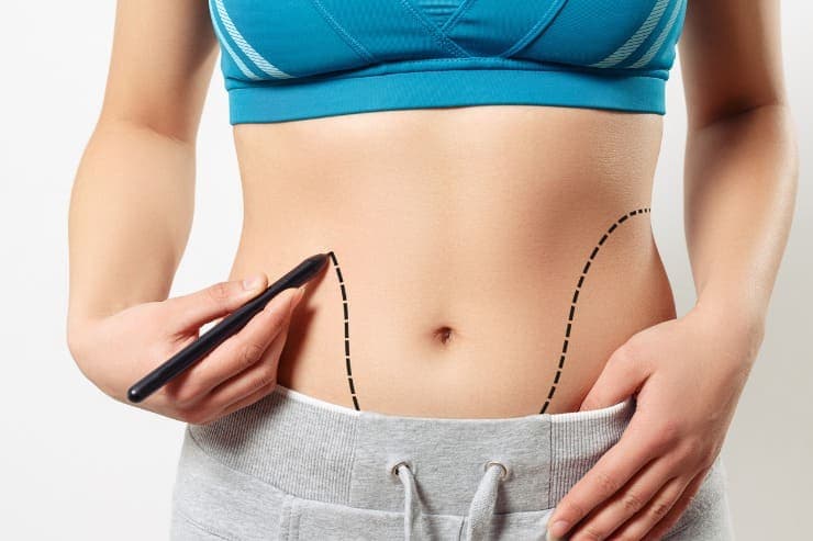 Dicas para cirurgia de correção de umbigo