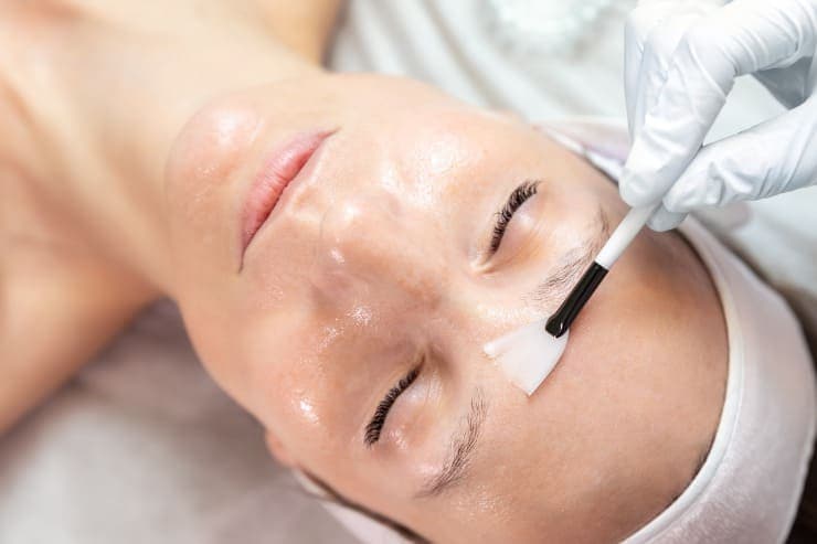 renovar a pele com peeling