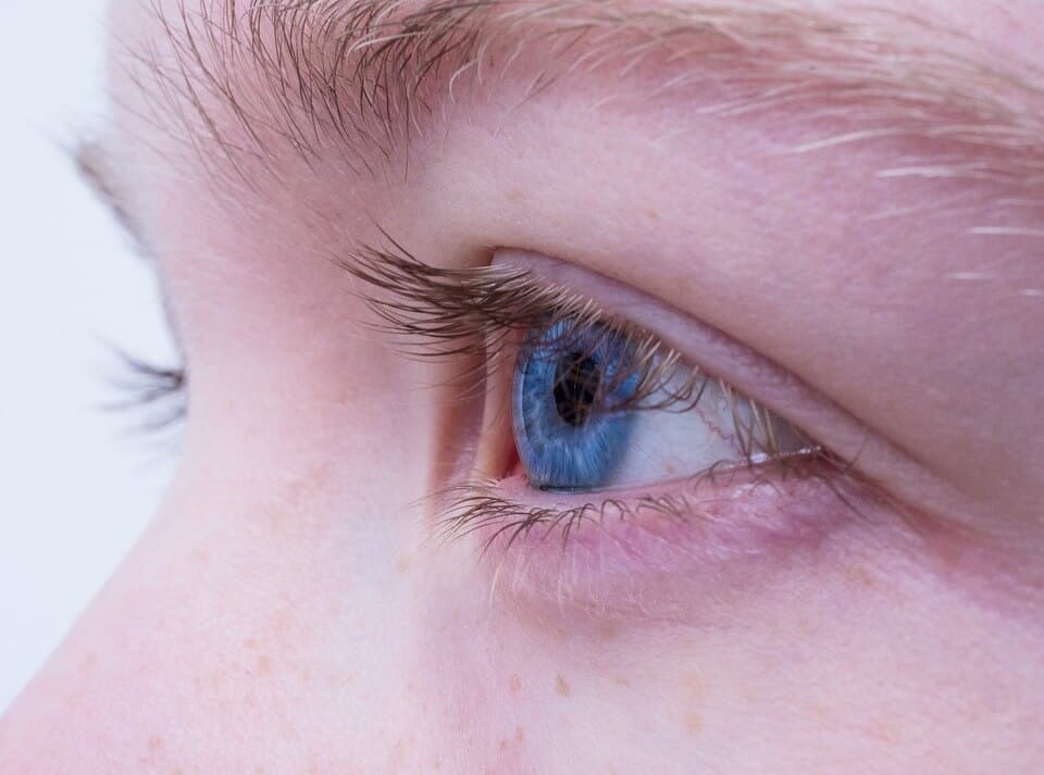 blefaroplastia