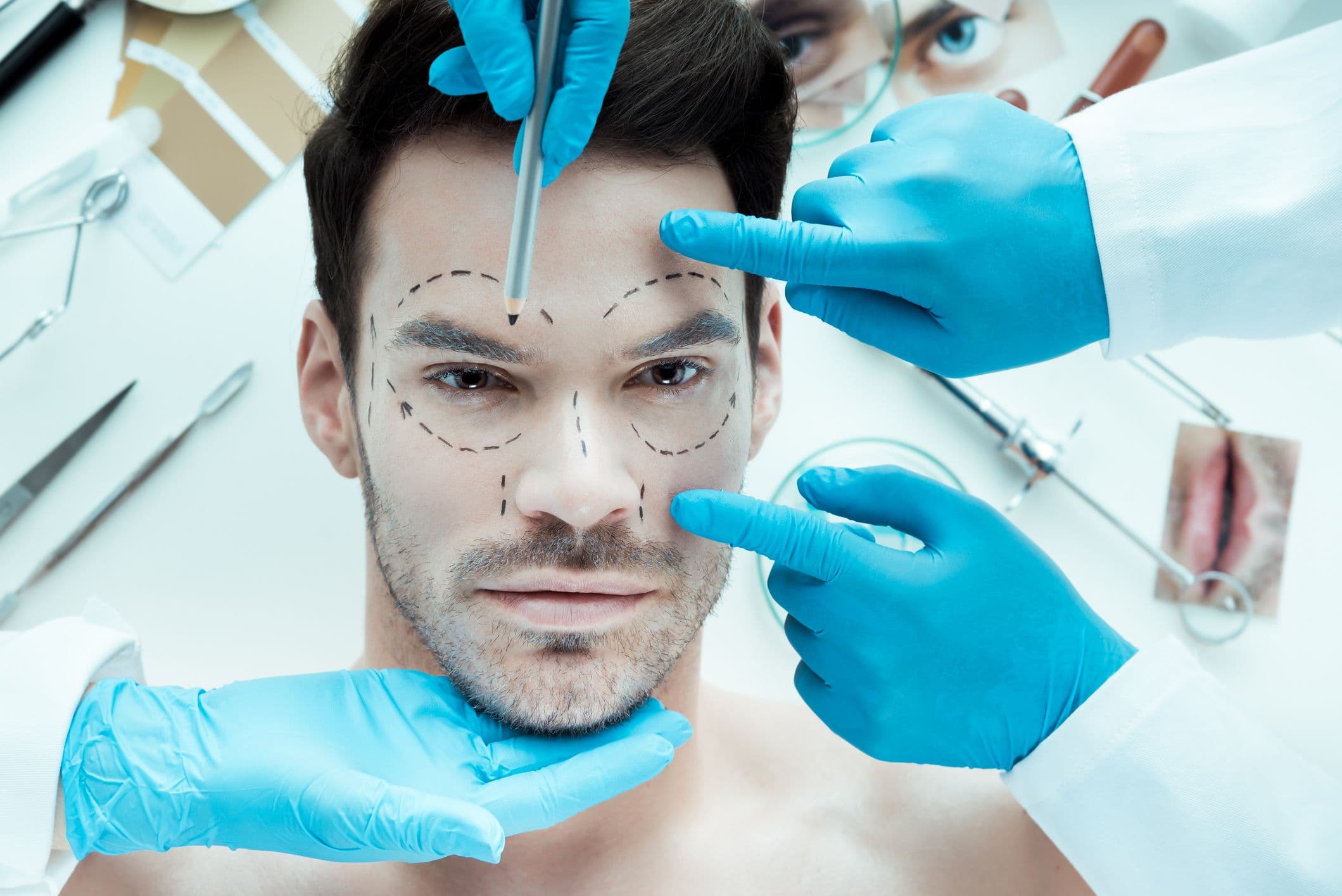 harmonização facial