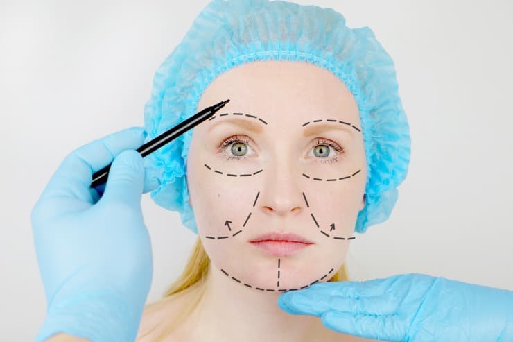 saiba quanto tempo após o lifting facial é possivel aplicar botox