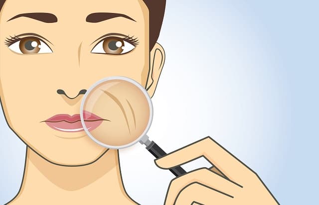 ilustração de mulher mostrando as linhas de expressão