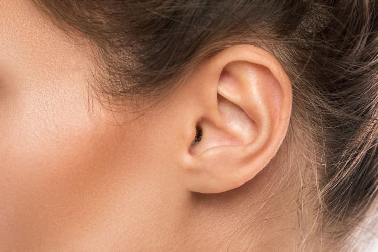 otoplastia para orelha de abano
