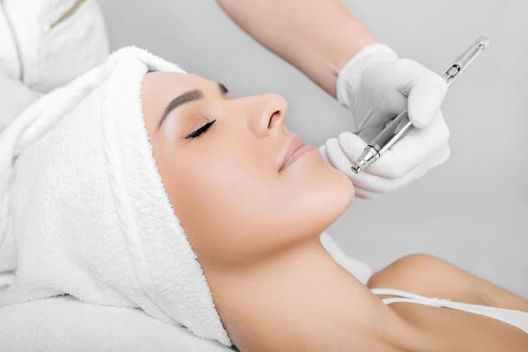 cuidados pós peeling facial