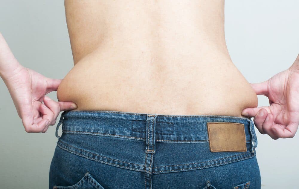 Mulher com a pele flácida após a lipoaspiração