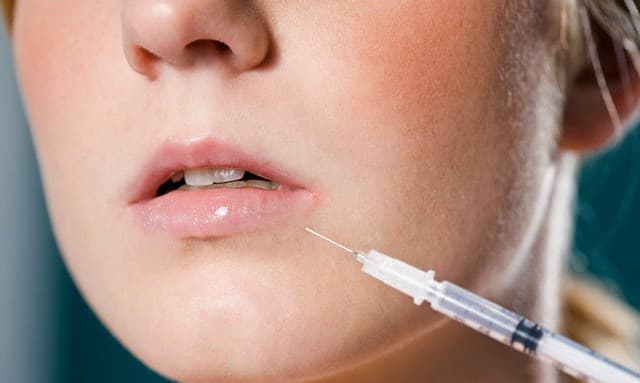 preenchimento labial