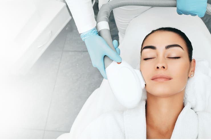 tratamentos para melasma