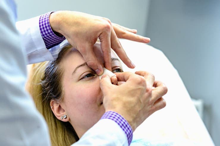 Entenda tudo sobre a cirurgia da rinoplastia