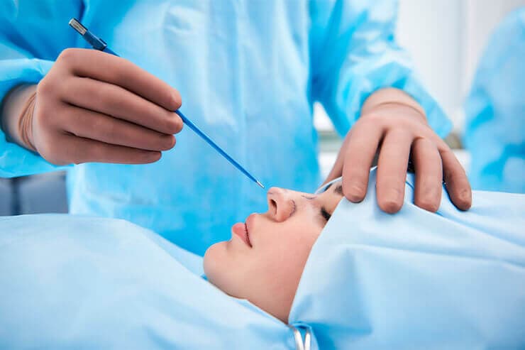 saiba mais sobre a rinoplastia e quando ela é indicada