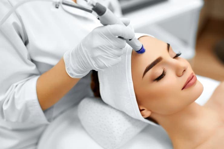 tratamentos estéticos para acne