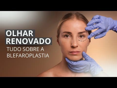 Blefaroplastia - O Passo a Passo da Cirurgia de Pálpebras