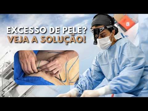 Flacidez após emagrecimento - tratamento com lipo, Morpheus, argoplasma e retirada de pele.