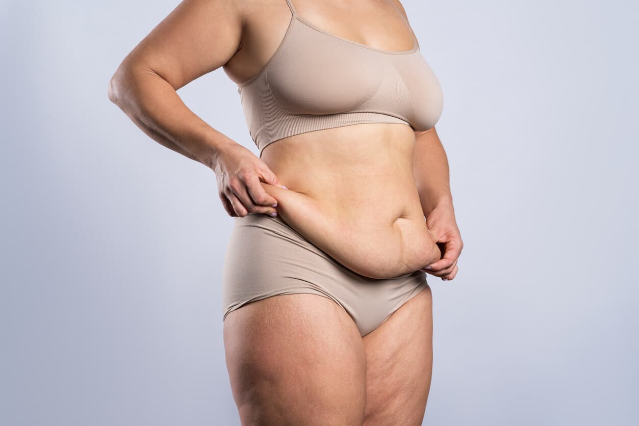 Mulher segurando o excesso de pele abdominal, ilustrando a indicação da abdominoplastia para remover flacidez e redefinir o contorno do abdômen