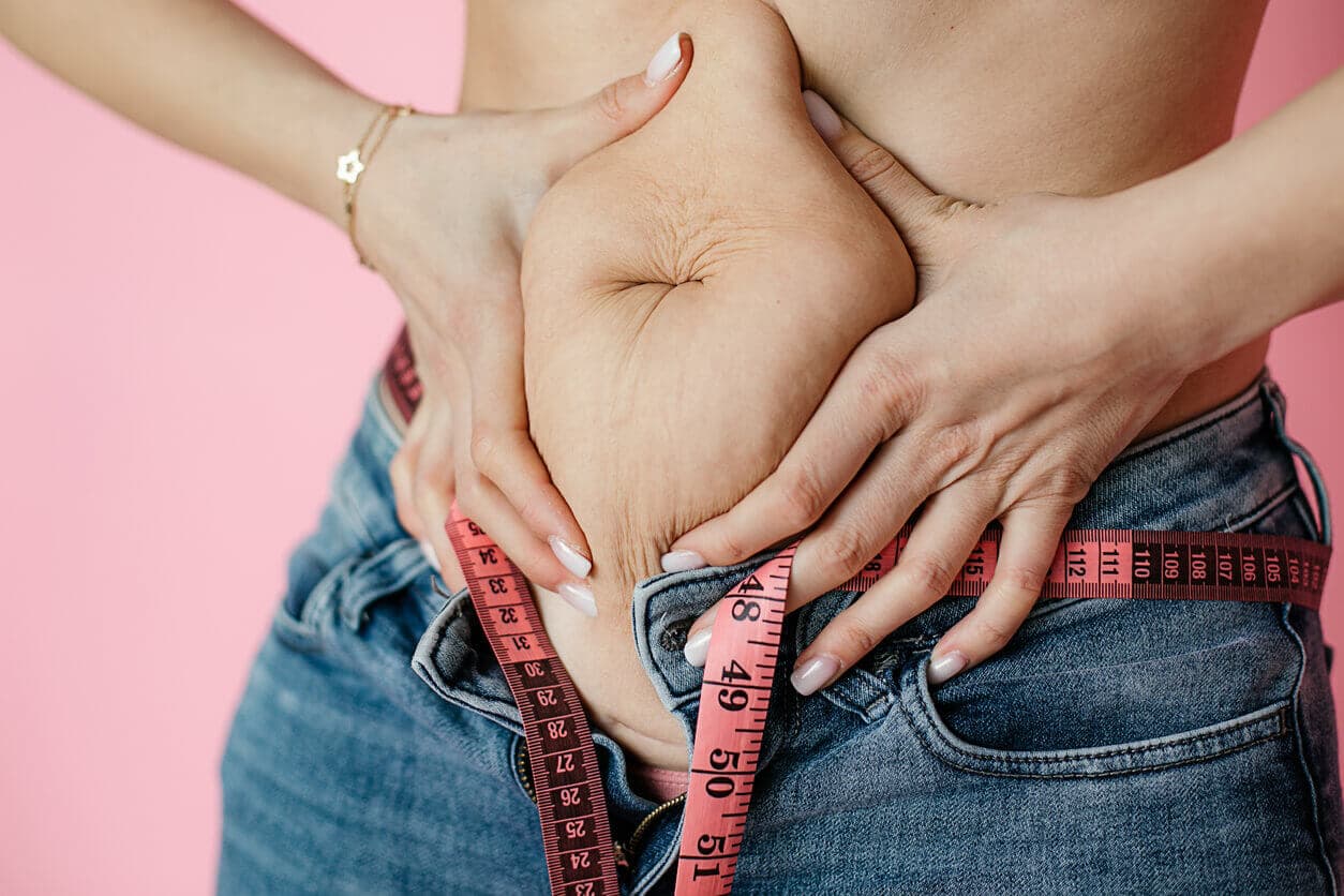 Mulher aperta as mãos ao redor do excesso de pele e flacidez no abdômen, indícios de um possível quadro de diástase abdominal