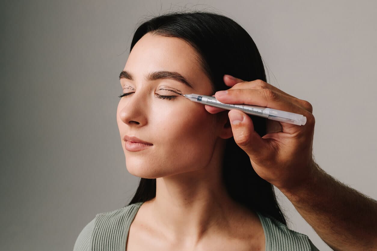 Mulher de olhos fechados durante marcação pré-operatória nas pálpebras feita por um profissional, ilustrando o preparo para uma cirurgia de blefaroplastia.