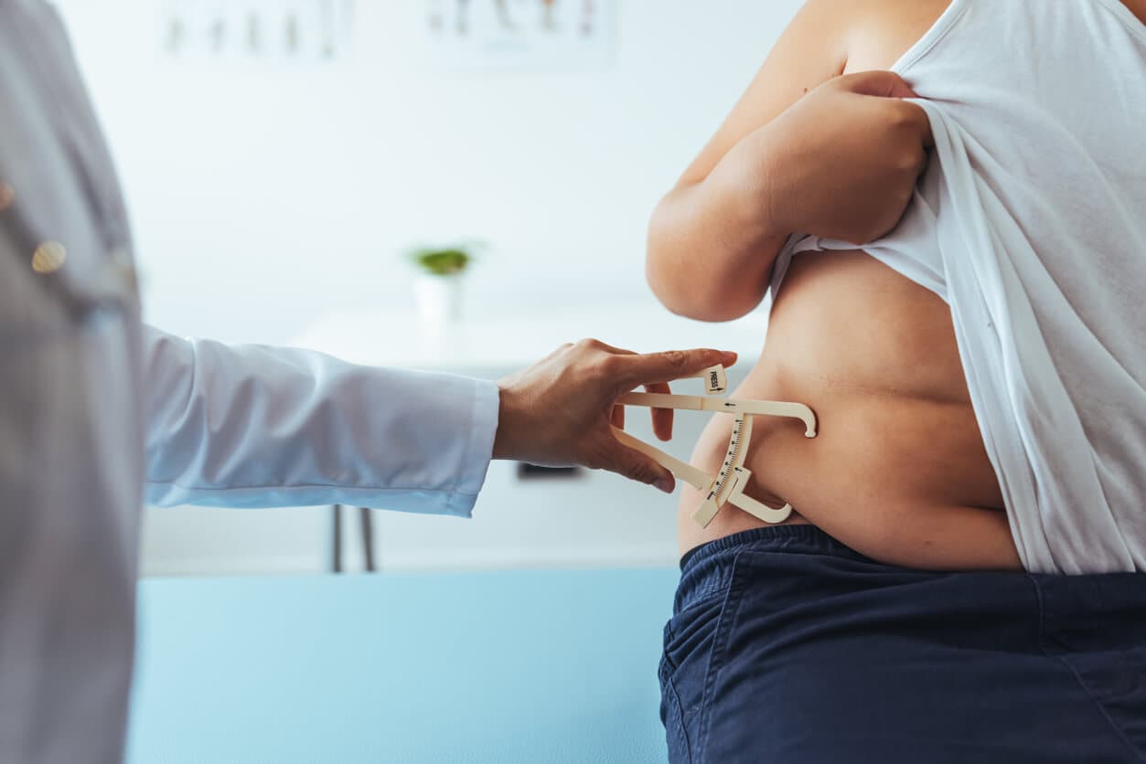 Pessoa com acúmulo de gordura abdominal sendo avaliada por profissional de saúde com adipômetro em consultório clínico.