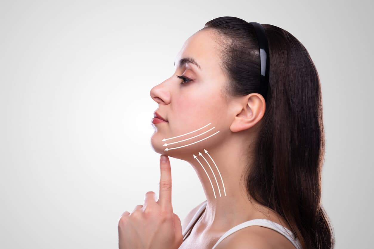 Mulher de perfil tocando o queixo, com setas indicando o sentido de elevação dos tecidos na região da mandíbula e do pescoço