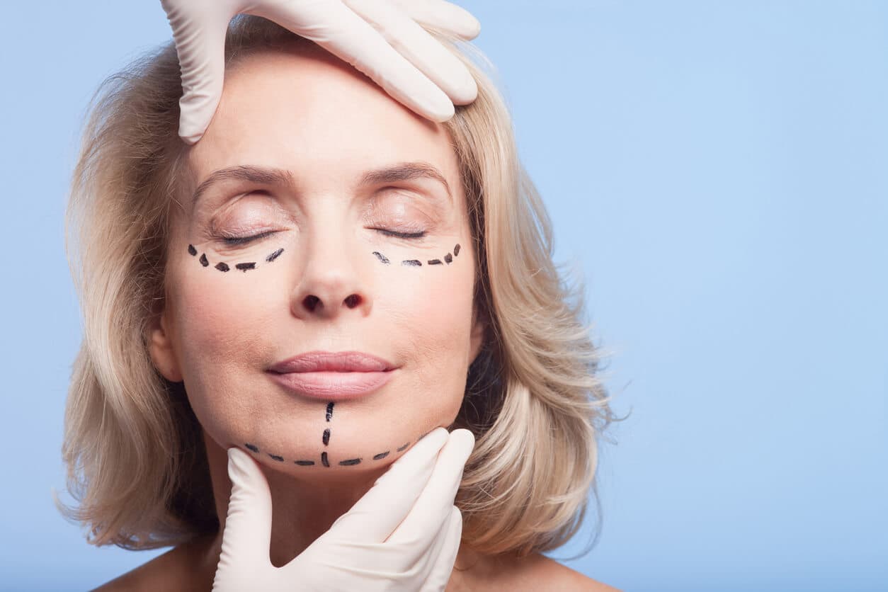 Mulher madura com olhos fechados, enquanto mãos com luvas brancas posicionam o rosto e destacam marcações cirúrgicas na região abaixo dos olhos e do contorno da mandíbula