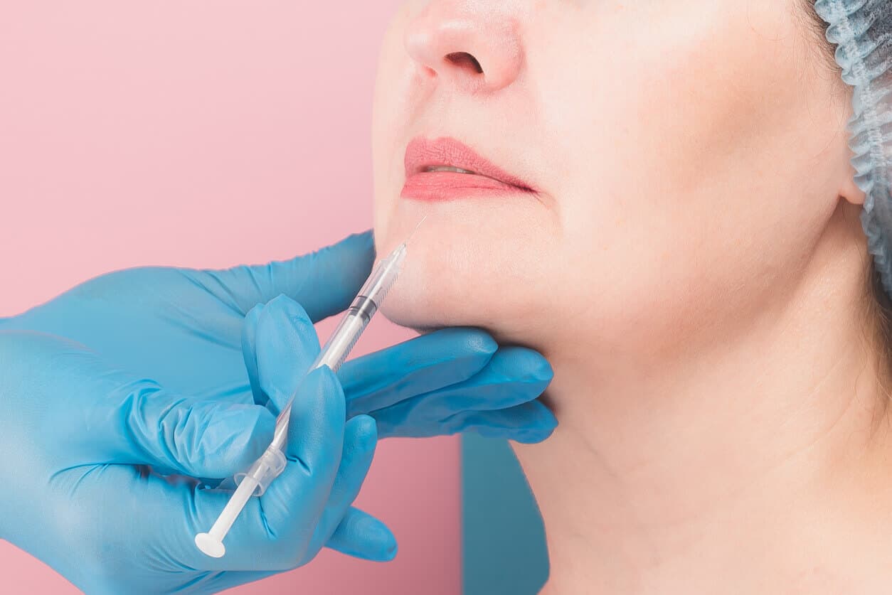Mulher recebendo aplicação de preenchimento facial com seringa na região do queixo