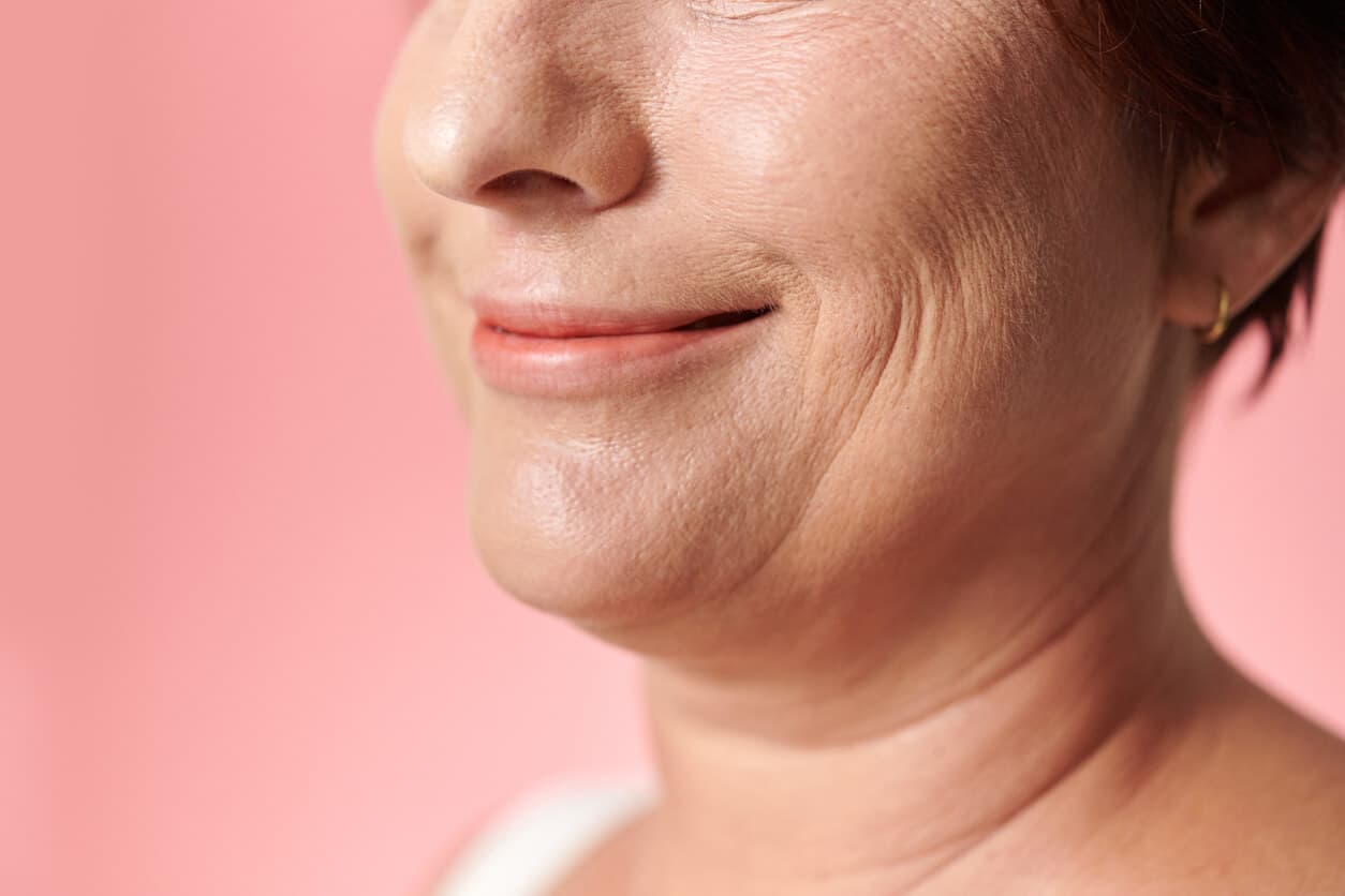Perfil de uma mulher madura sorrindo, revelando a presença de jowls na linha do maxilar