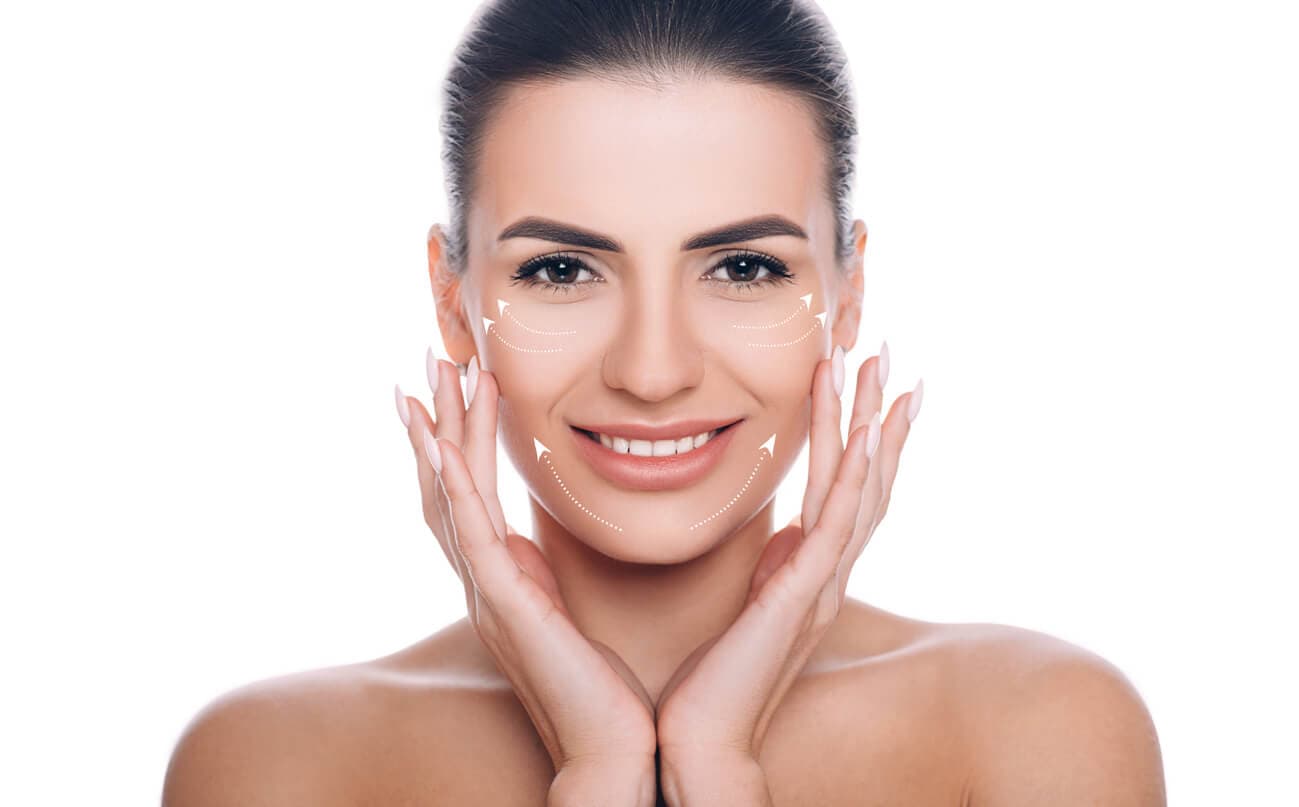 Mulher jovem levando as mãos à bochecha, com setas no rosto indicando as regiões em que foram realizadas técnicas de lifting facial