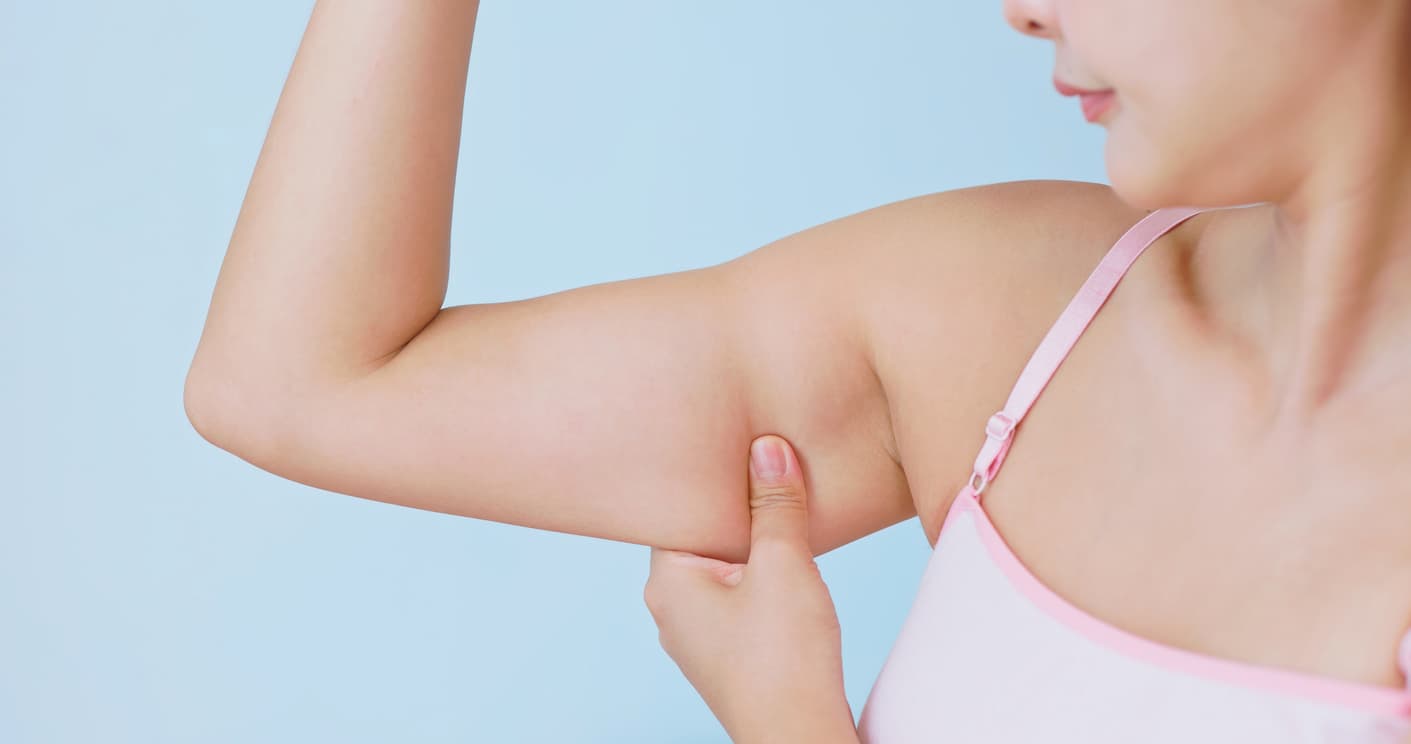 Mulher segurando o excesso de pele e gordura dos braços