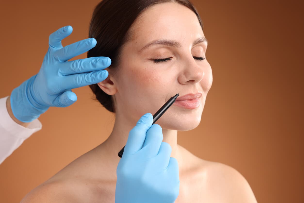 Paciente passa por avaliação facial com marcações para planejamento de procedimento.