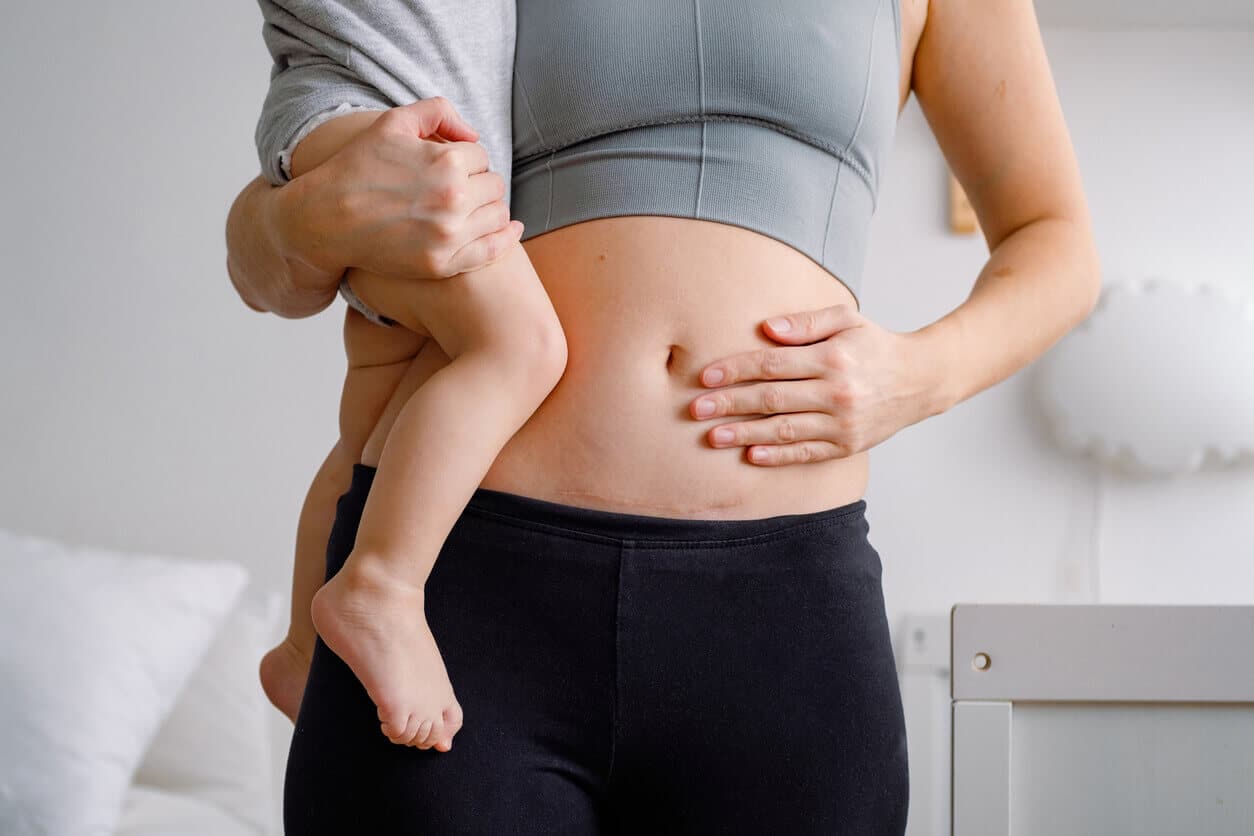 Mulher no pós-parto segura bebê no colo, com foco no abdômen, representando transformações corporais e cuidados com o corpo após a maternidade.