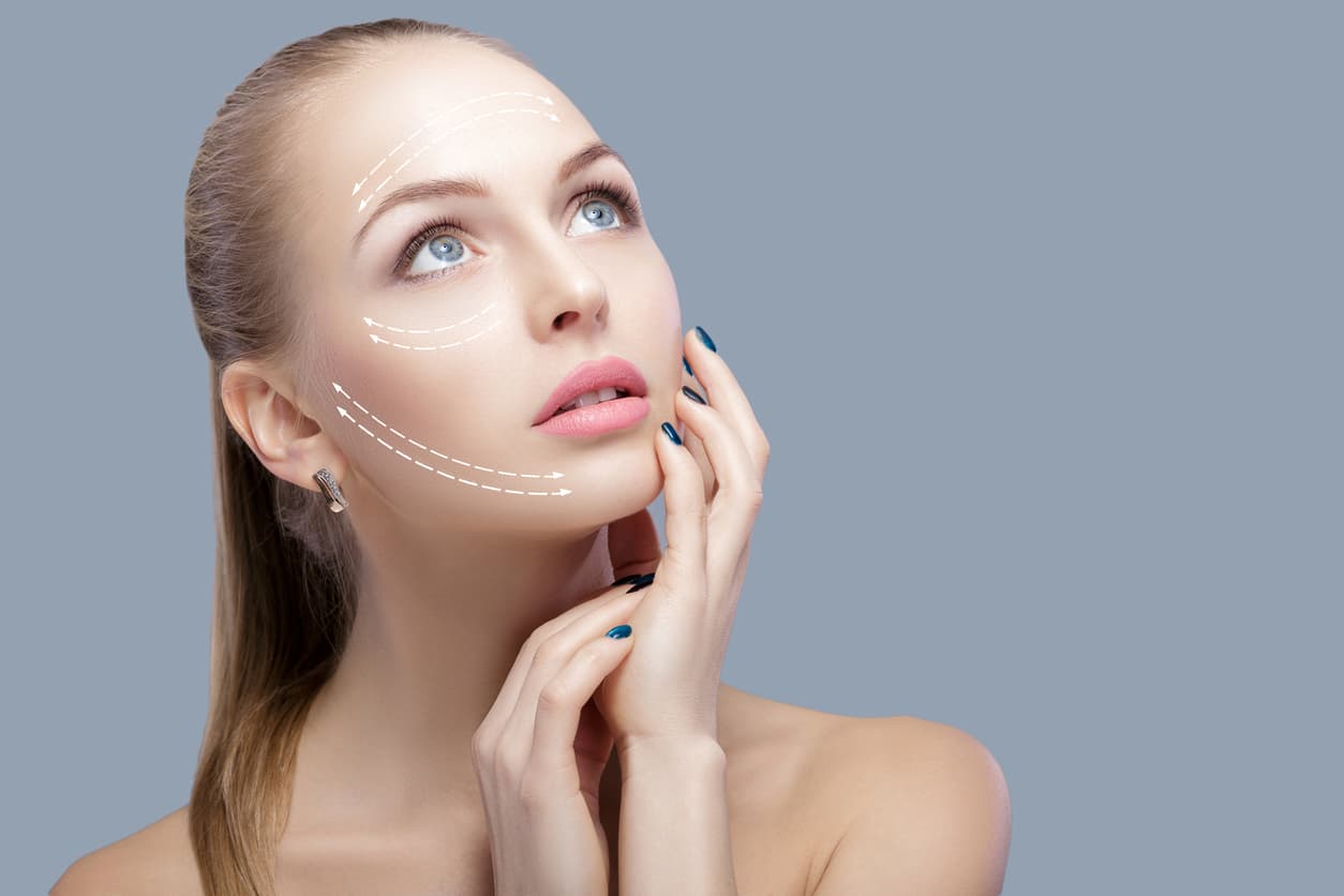 Mulher jovem com setas brancas no rosto indicando as áreas de melhoria após o microlifting