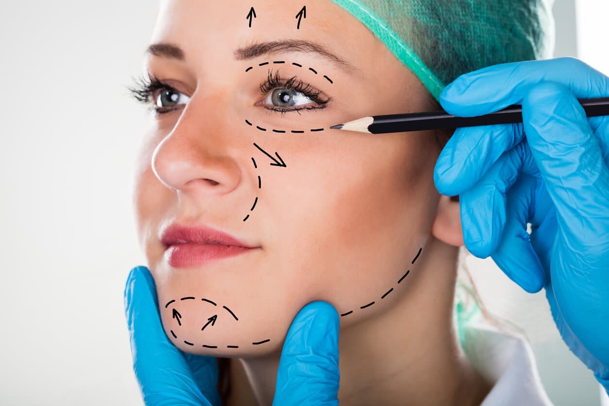 Mulher com marcações faciais pré-operatórias enquanto um profissional com luvas azuis aponta regiões do rosto com lápis cirúrgico