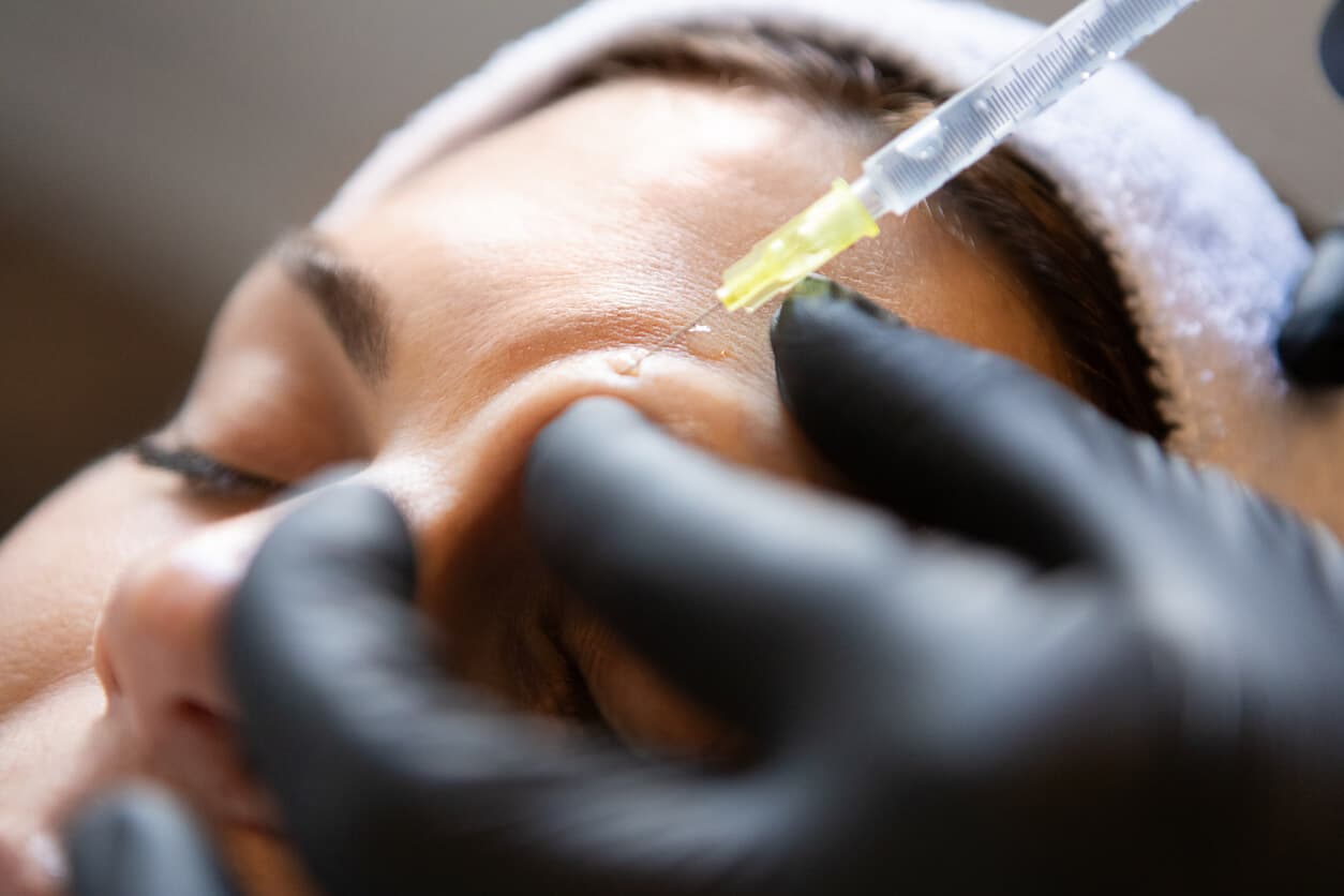 Paciente recebendo injeção de toxina botulínica na testa