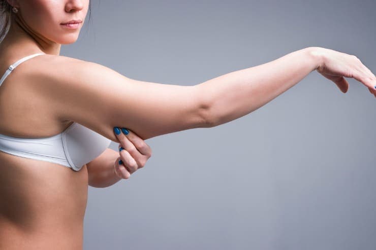 braquioplastia para excesso de pele