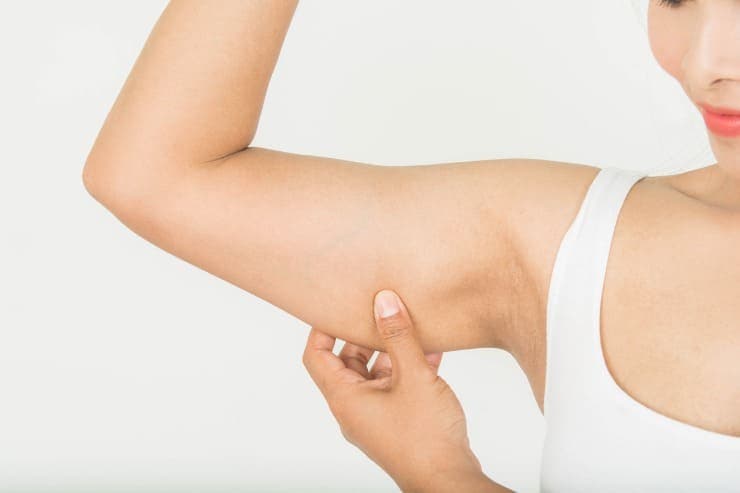 recuperação braquioplastia