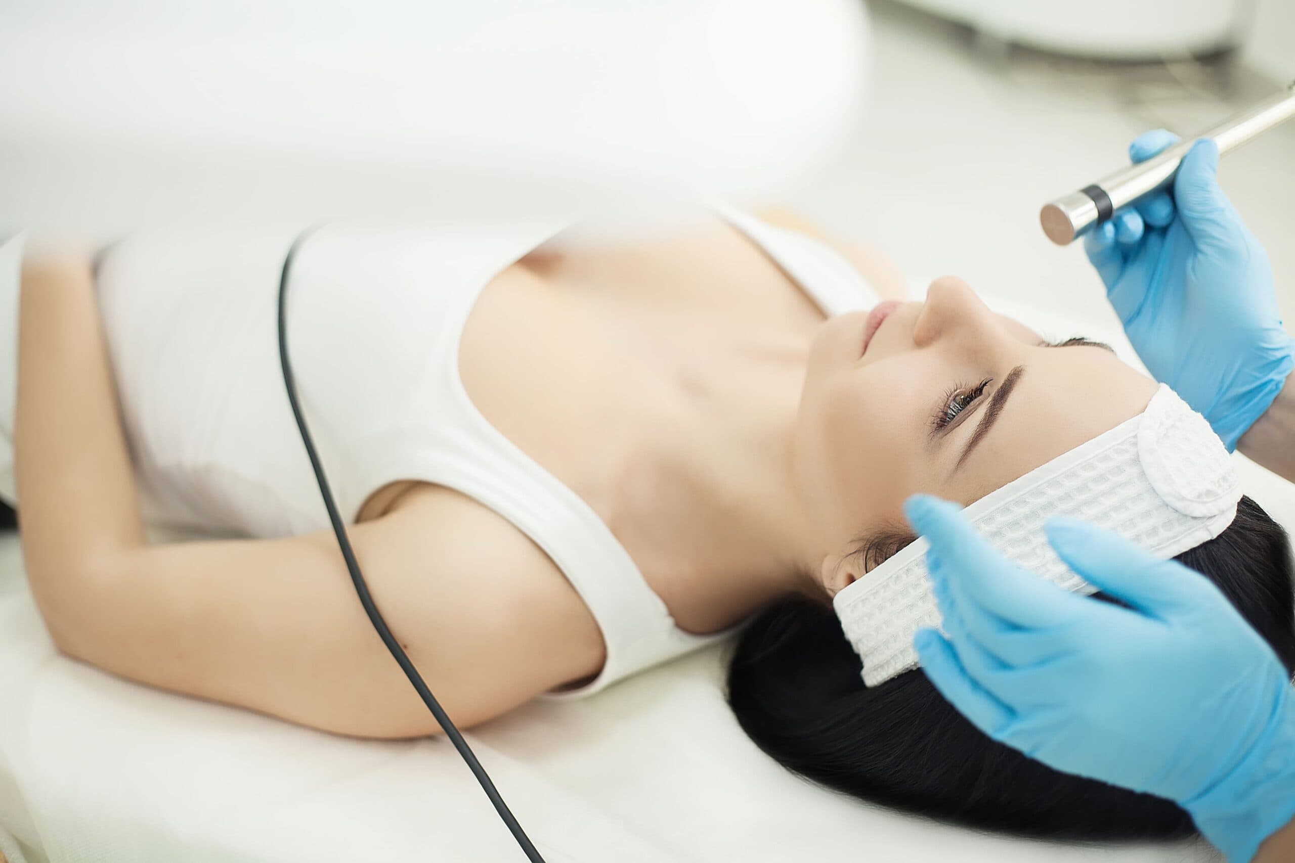 microagulhamento facial
