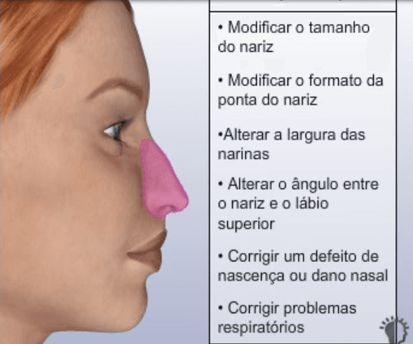 objetivos ao realizar uma rinoplastia