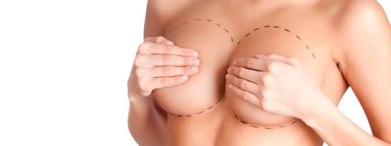 Silicone