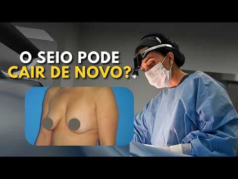 Mastopexia com ou sem prótese: o que faz o seio cair de novo?
