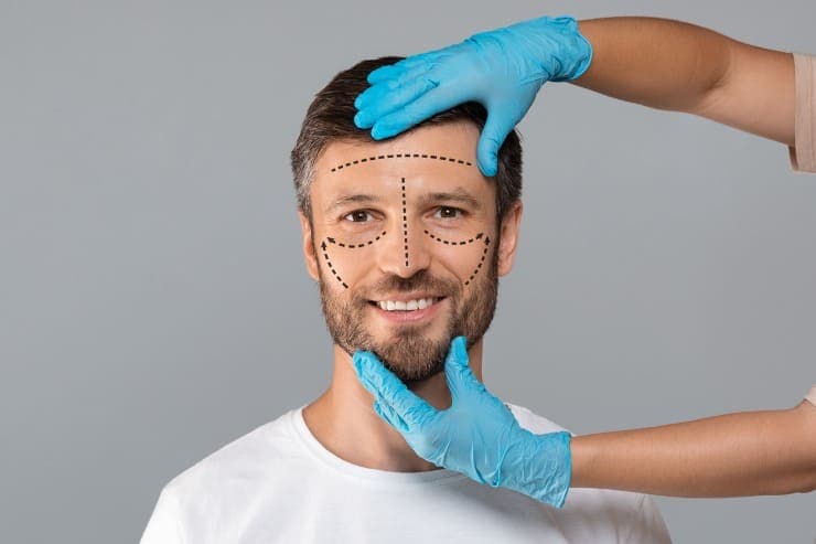 harmonização facial em homens